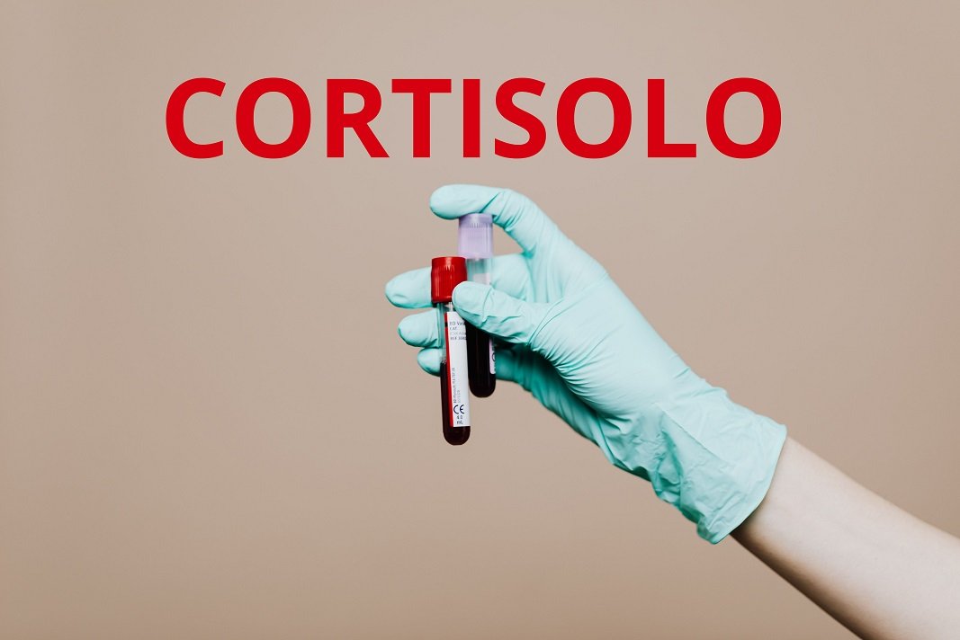 Nutrizionista Catania | Diete Personalizzate Dott  Antonino Girone